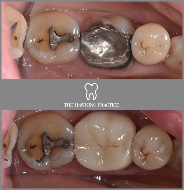 Before & After